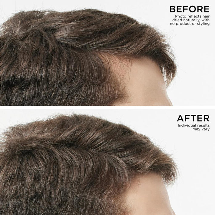 Before and After Results